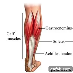 Calf muscle breakdown with arrows pointing to the soleus, gastrocnemius and achilles tendon
